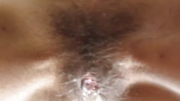Anaalse orgasmi fänn. lesbisexs